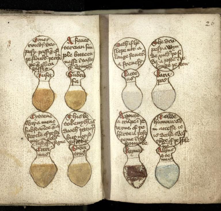 Fifteenth-century drawings of urine flasks 